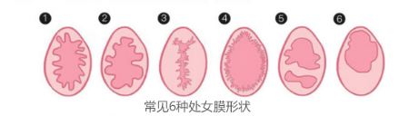 卫生棉条会破坏膜吗2